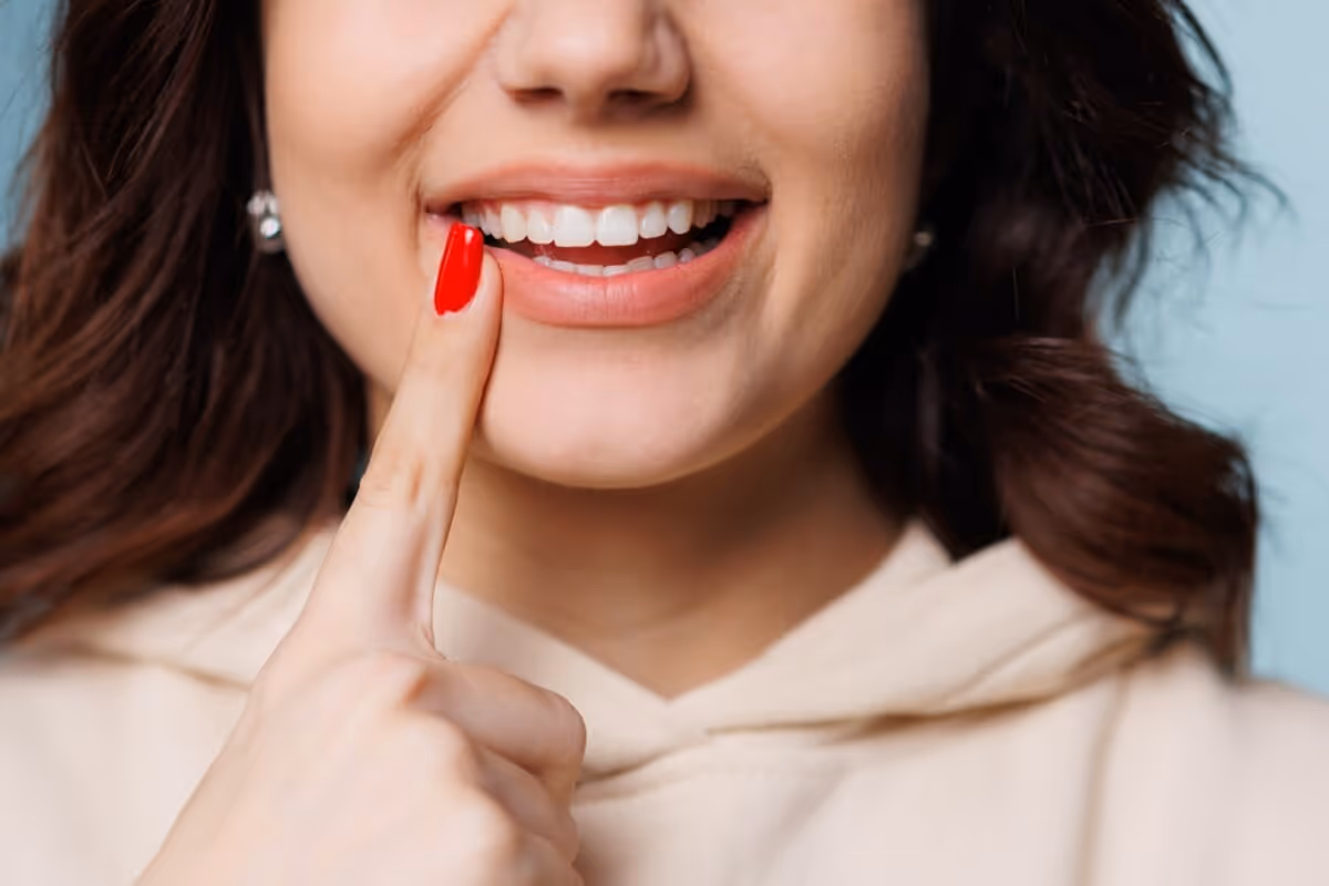 Teeth whitening treatment in Burlington