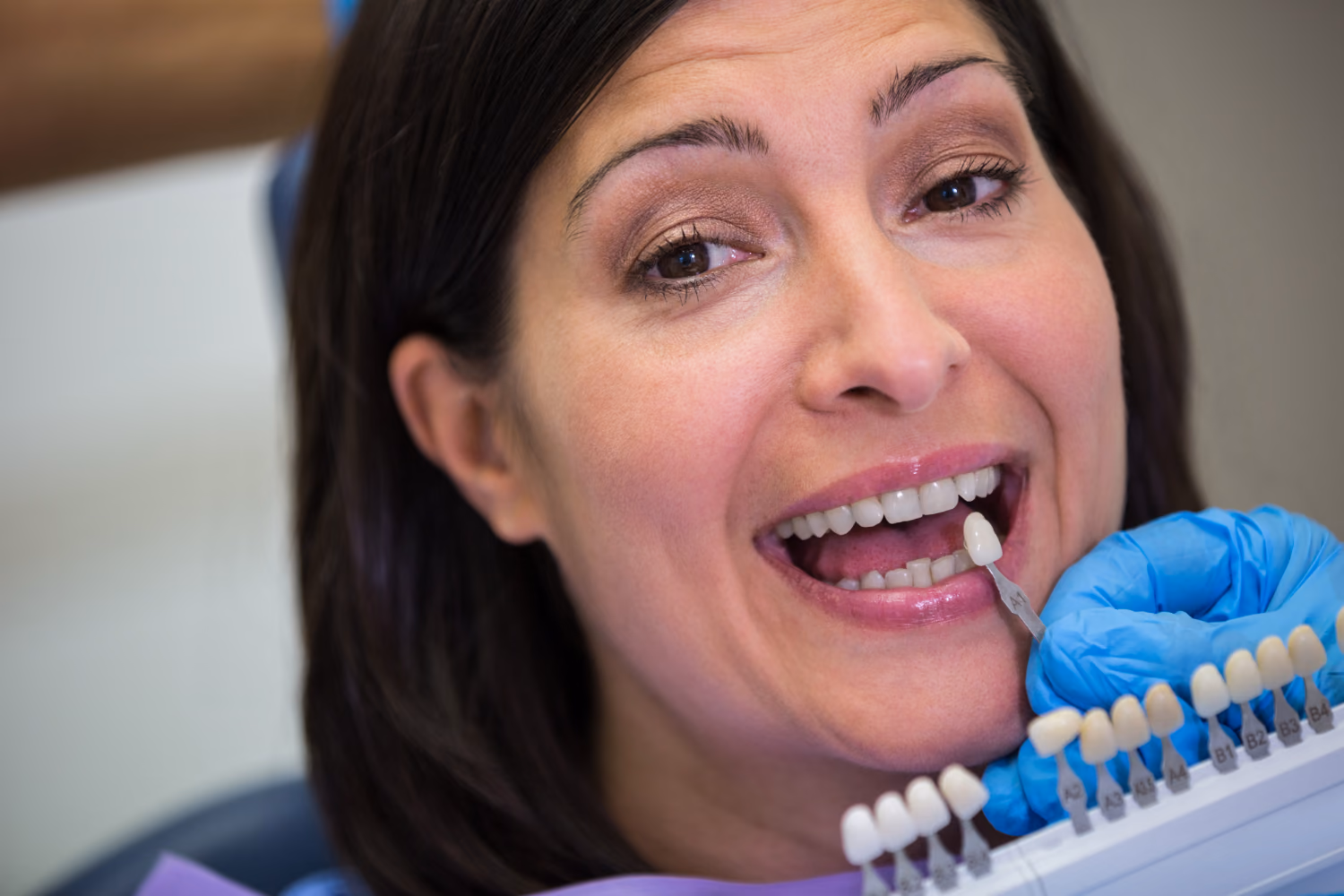 All-on-4 dental implants treatment in Burlington